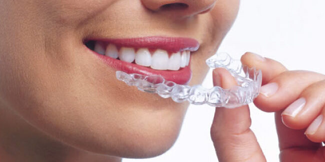 invisalign-ortodoncia-invisible-vitoria-gasteiz-clinica-mozas-antes