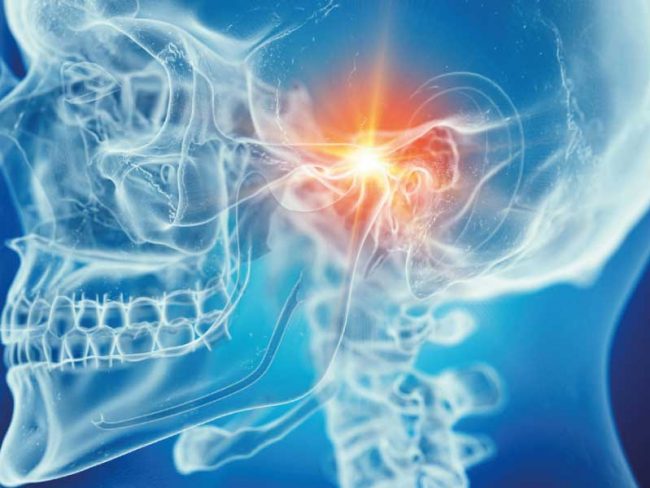 anatomia-craneal-de-la-boca-clinica-dental-mozas-vitoria-gasteiz Anatomía craneal de la boca Clínica Dental Mozas