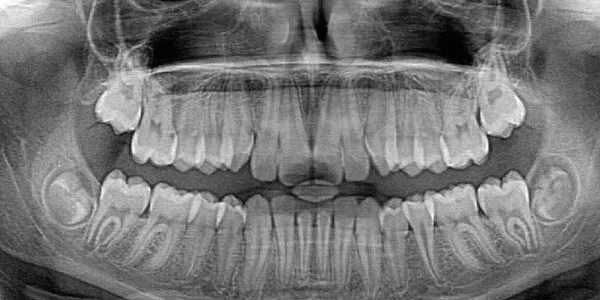 radiologia-dental-clinica-dental-mozas-vitoria-gasteiz Radiología Dental Clínica Dental Mozas Vitoria-Gasteiz