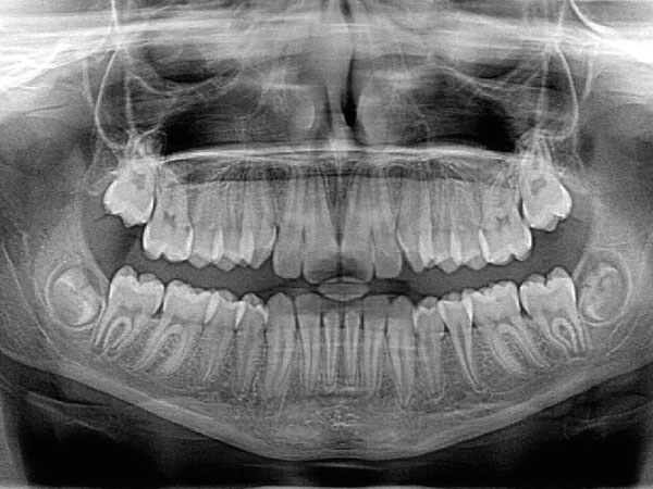 Radiología Dental Clínica Dental Mozas Vitoria-Gasteiz