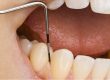 ¿Sabes lo que es el periodonto?
