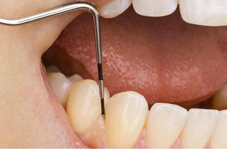 ¿Sabes lo que es el periodonto?