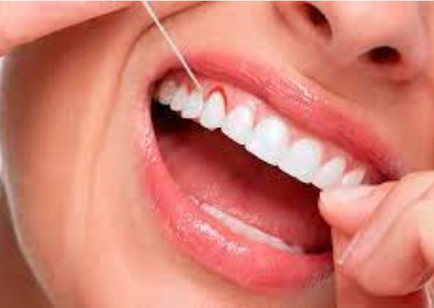 El color de tus encías determina tu salud bucodental