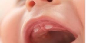 Qué dientes salen primero