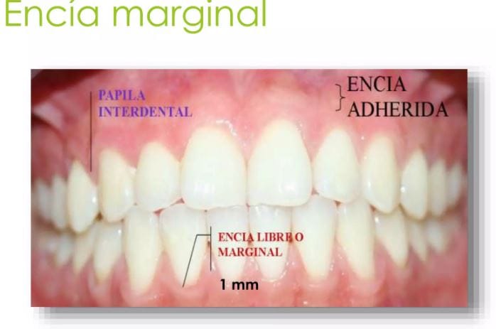 Todo sobre tu encía - Clínica Dental Mozas | Vitoria-Gasteiz