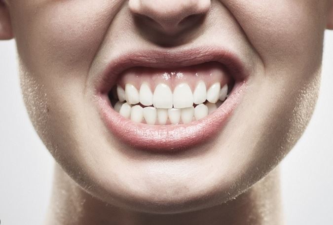 Férula dental para el bruxismo