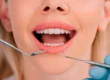 ¿Qué es la exploración periodontal?