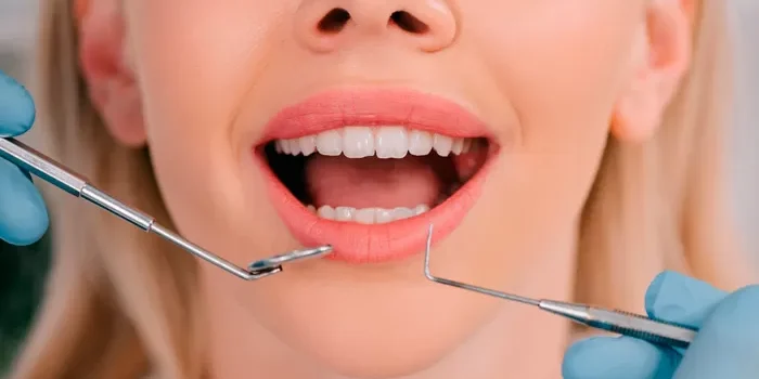 ¿Qué es la exploración periodontal?