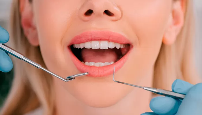 ¿Qué es la exploración periodontal?