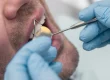 Periodoncia en Vitoria