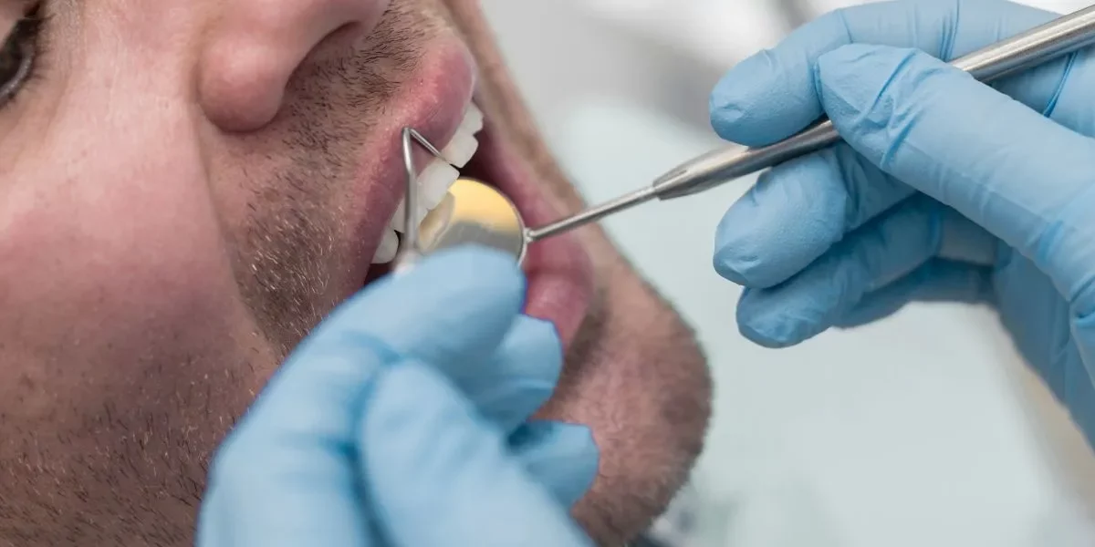 Periodoncia en Vitoria