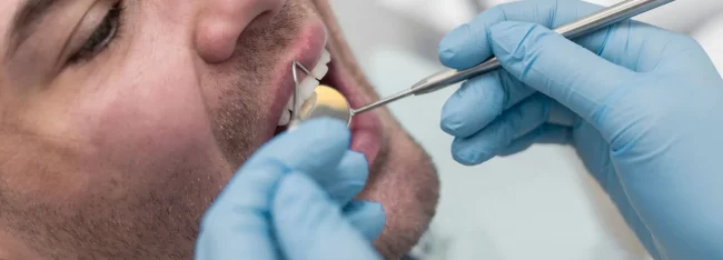 Periodoncia en Vitoria