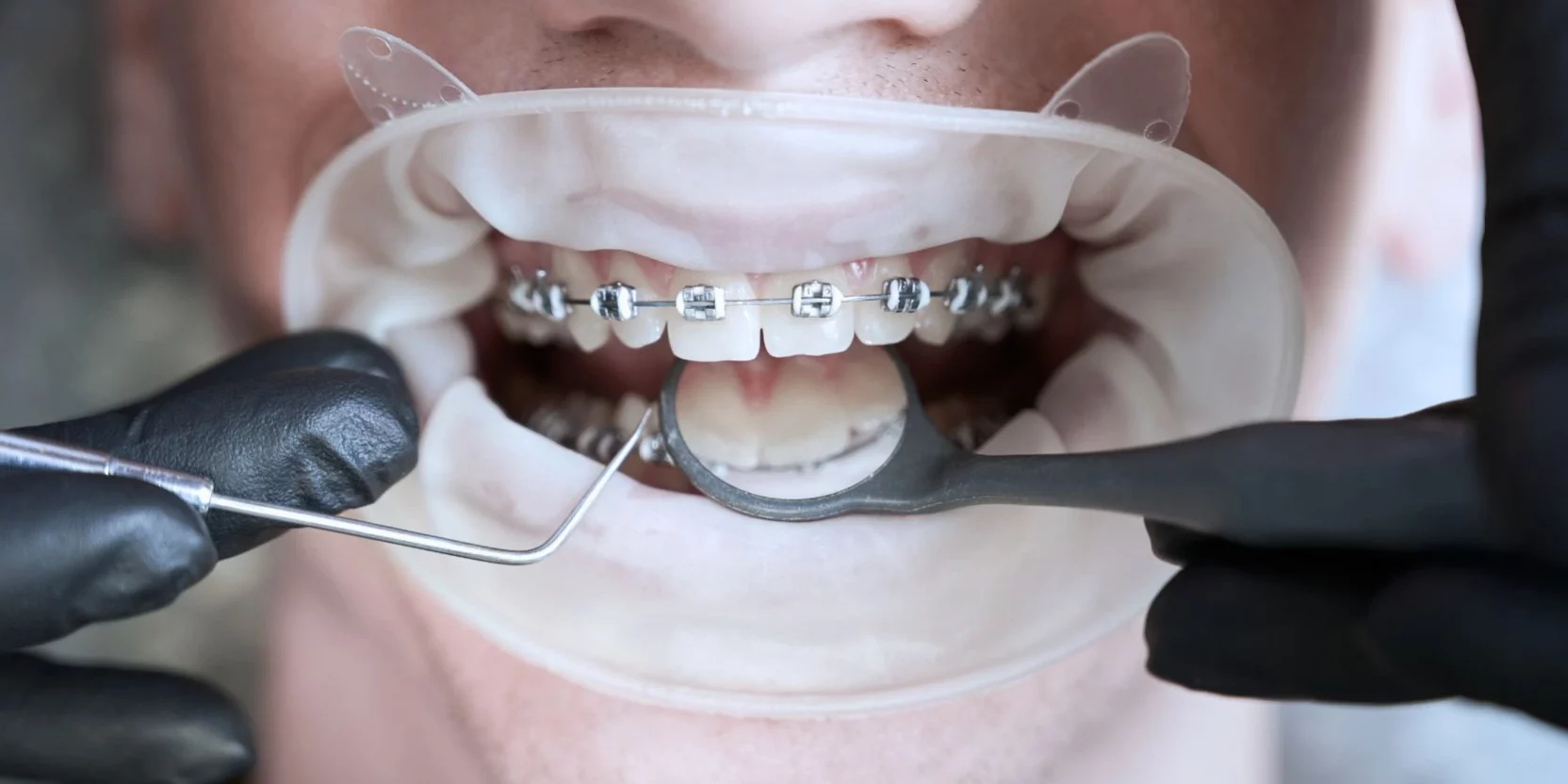 Ortodoncistas expertos en tratamientos dentales Ortodoncistas expertos en tratamientos dentales