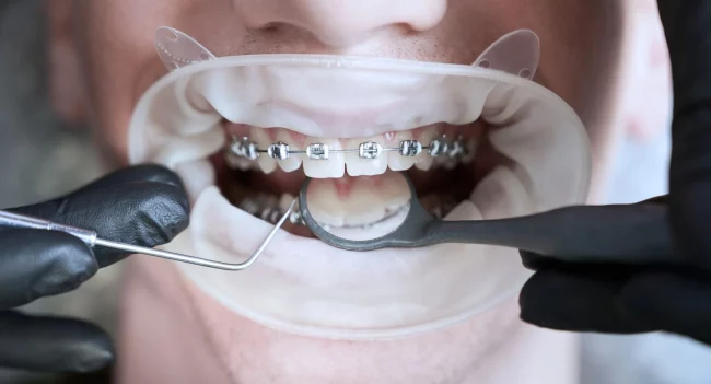 Ortodoncistas expertos en tratamientos dentales