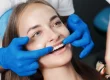 ¿Debería hacerme un blanqueamiento dental? Clínica dental Vitoria