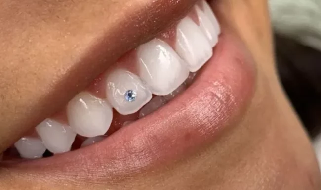 Moda dental vitoria