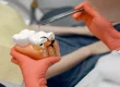 caries sin dolor