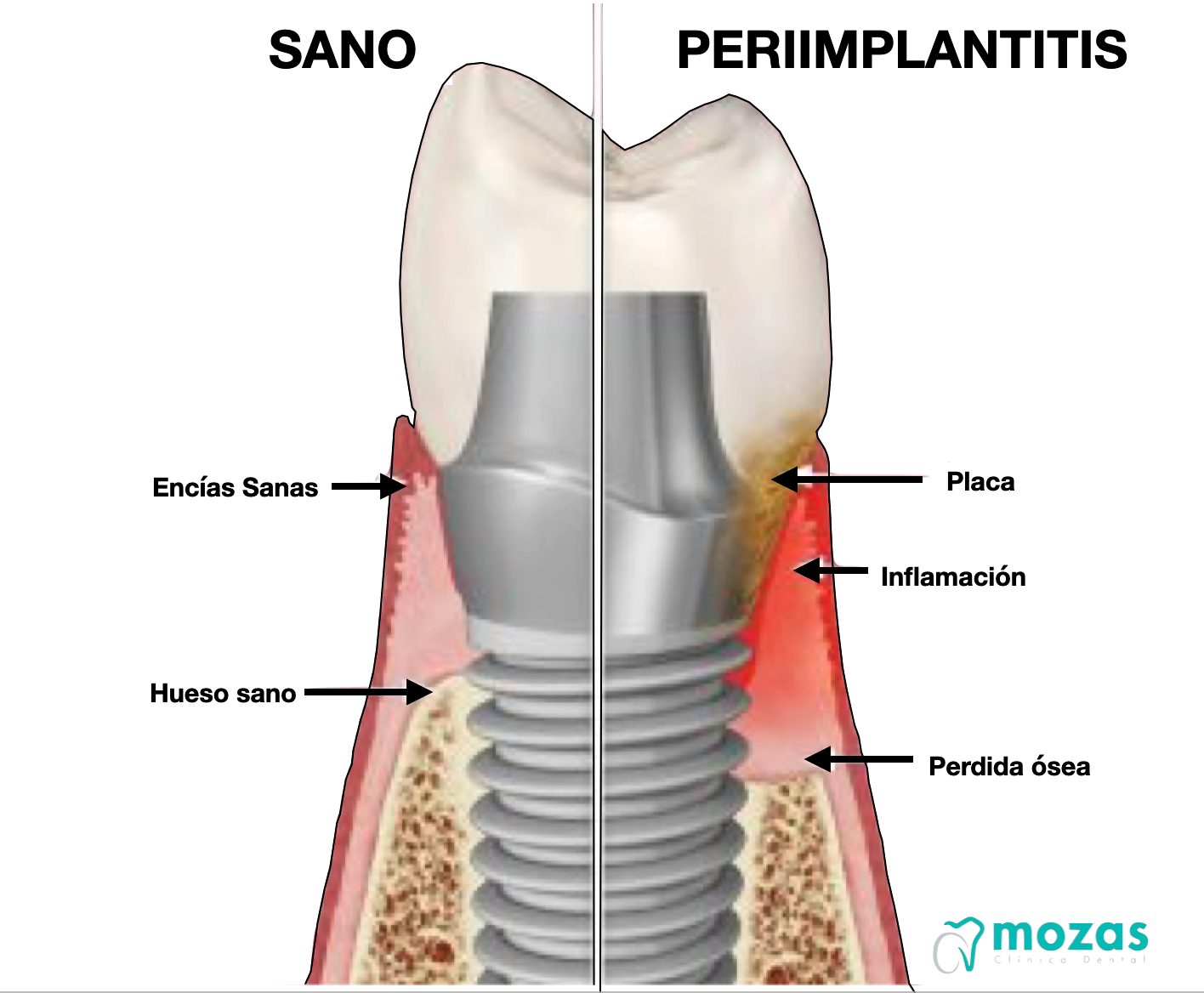 revisión y limpieza dental