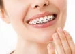 dientes con ortodoncia