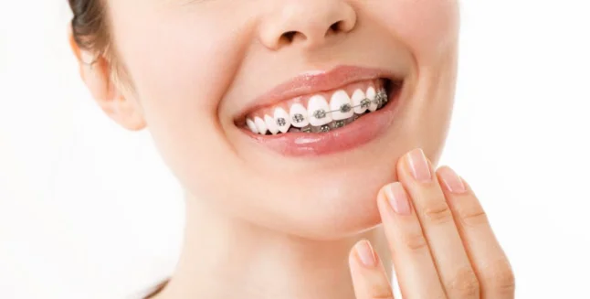 dientes con ortodoncia